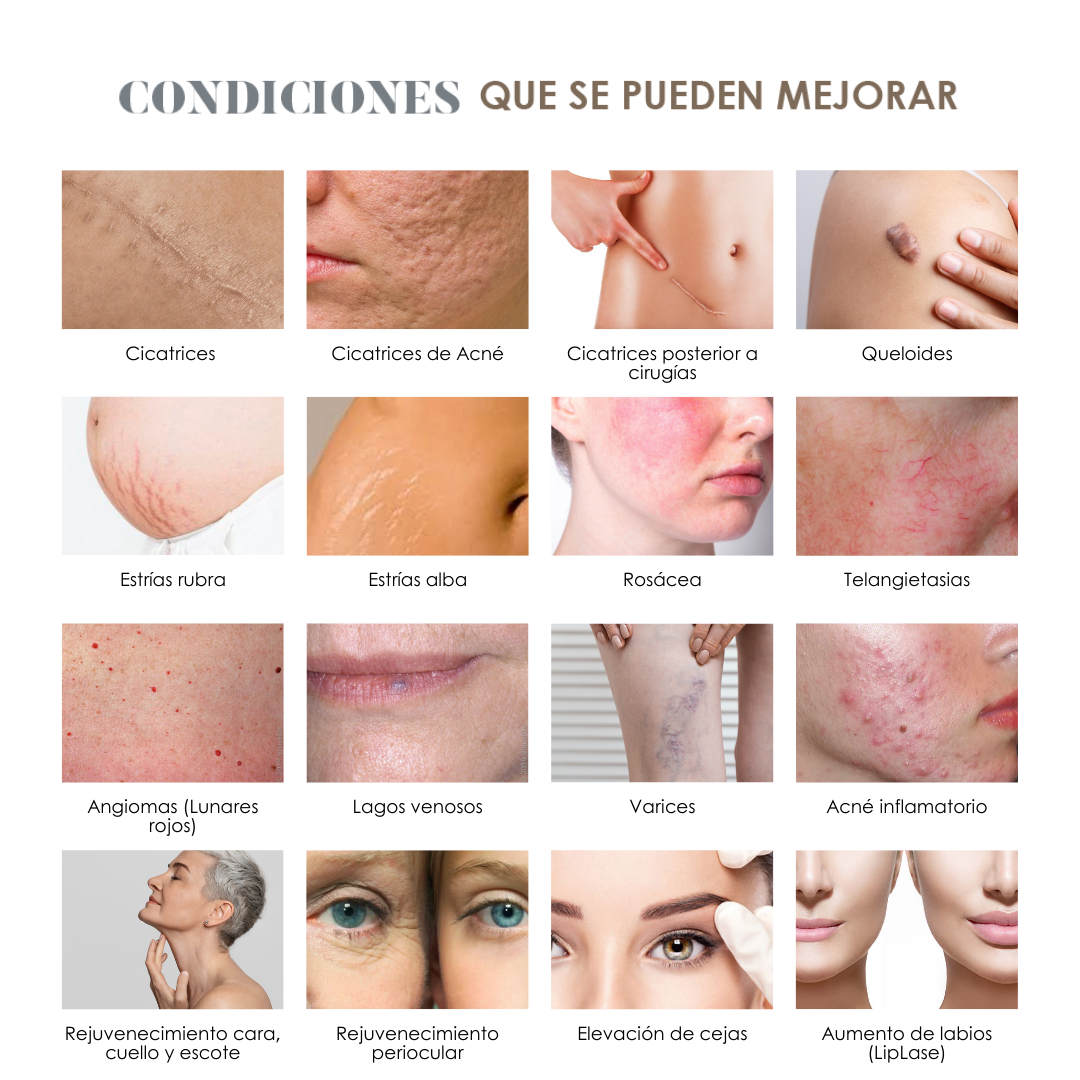 Fotona SP Dynamis Pro