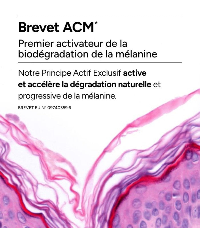 ACM - DÉPIWHITE Advanced