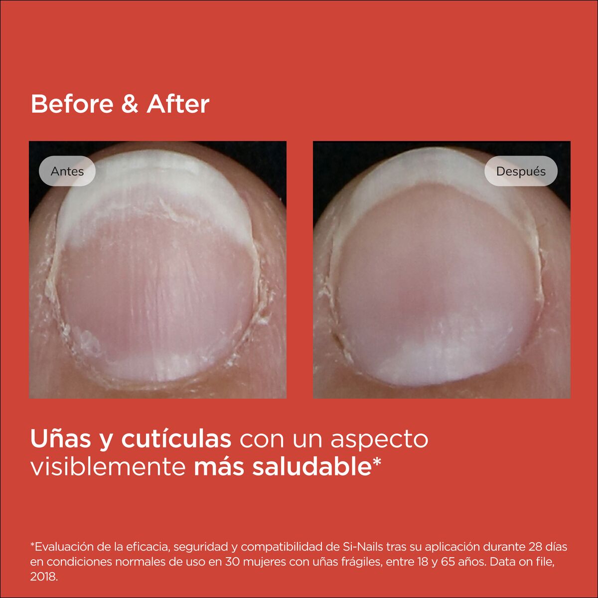 ISDIN - Si-Nails Fortalecedor de Uñas