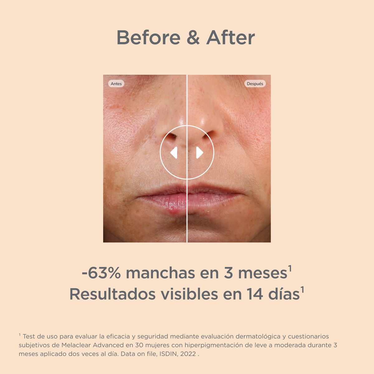 ISDIN - Melaclear Advanced Serum - Isdinceutics