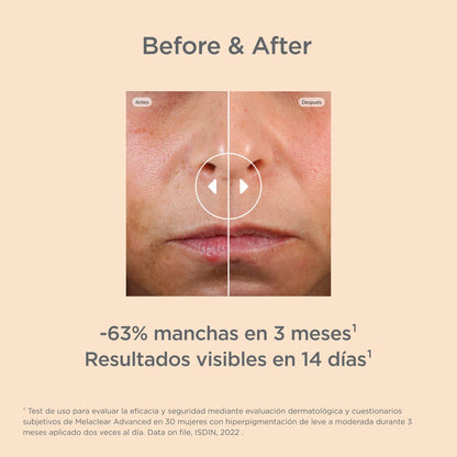 ISDIN - Melaclear Advanced Serum - Isdinceutics